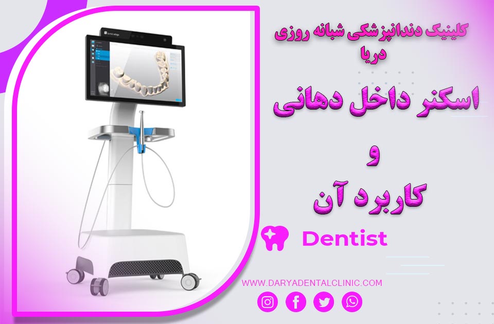 اسکنر داخل دهانی و کاربرد آن در دندانپزشکی