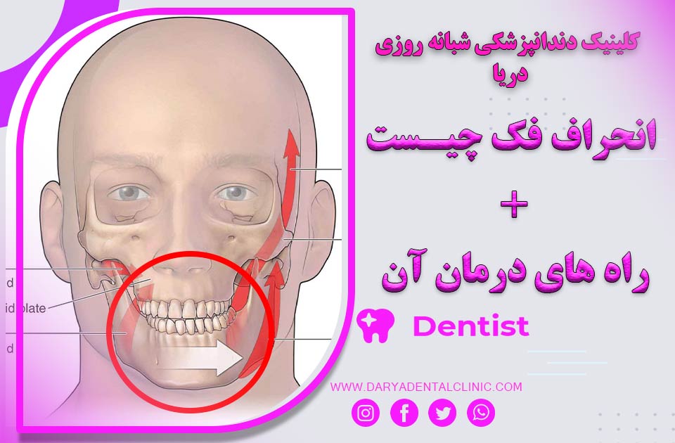 انحراف فک و راه‌های درمان آن