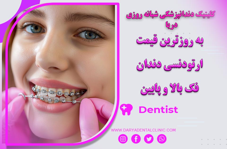 به روزترین قیمت ارتودنسی دندان ( فک بالا و پایین ) سال 1403