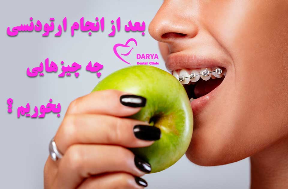 بعد از انجام ارتودنسی چه چیز هایی بخوریم ؟