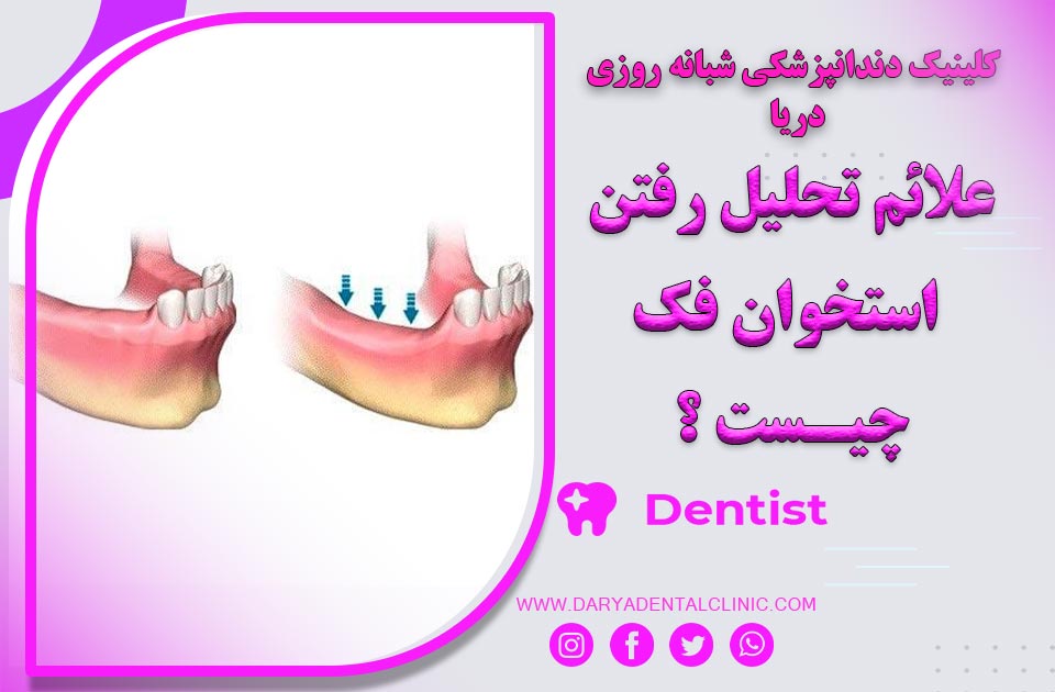 علائم تحلیل رفتن استخوان فک چیست ؟