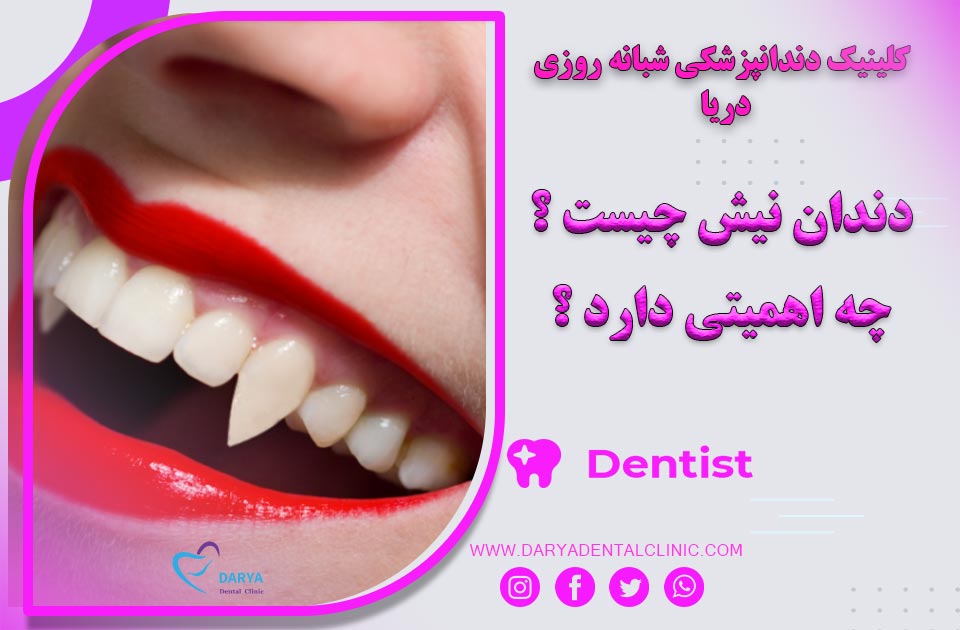 دندان نیش چیست ؟ و چه اهمیتی دارد ؟