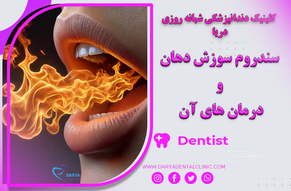 سندروم سوزش دهان و درمان‌ های آن