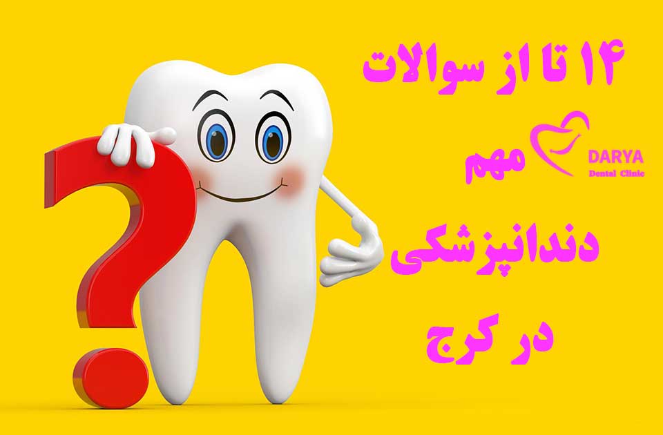14 تا از سوالات مهم دندانپزشکی در کرج