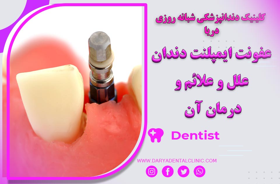 عفونت ایمپلنت دندان: علل، علائم و درمان