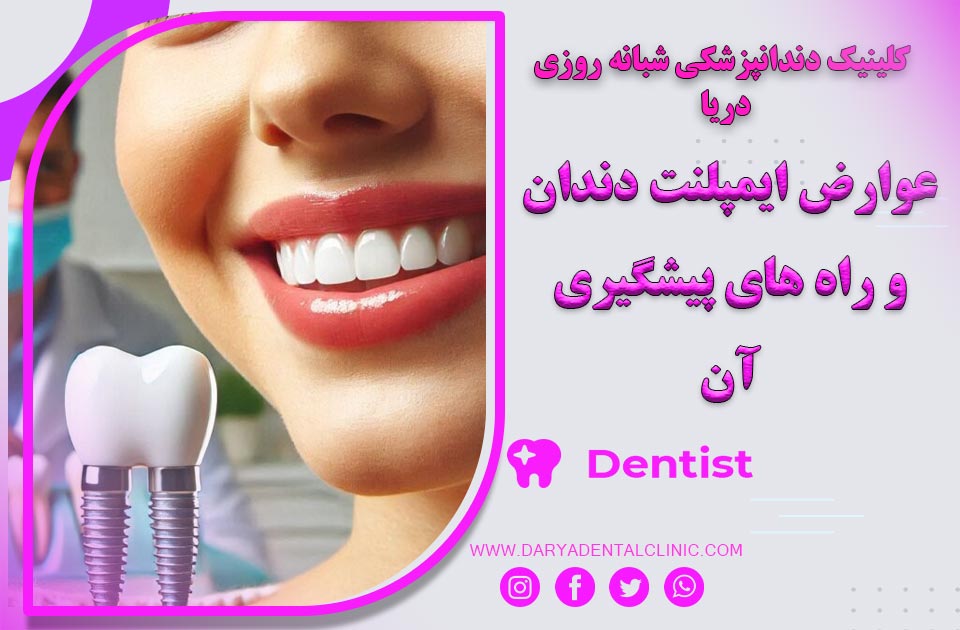 عوارض ایمپلنت دندان و راه های پیشگیری آن که باید بدانید !