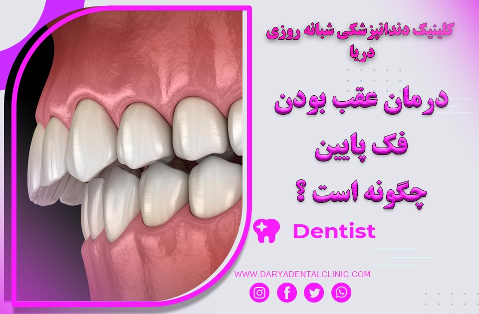 عقب بودن فک پایین چطور درمان می شود ؟