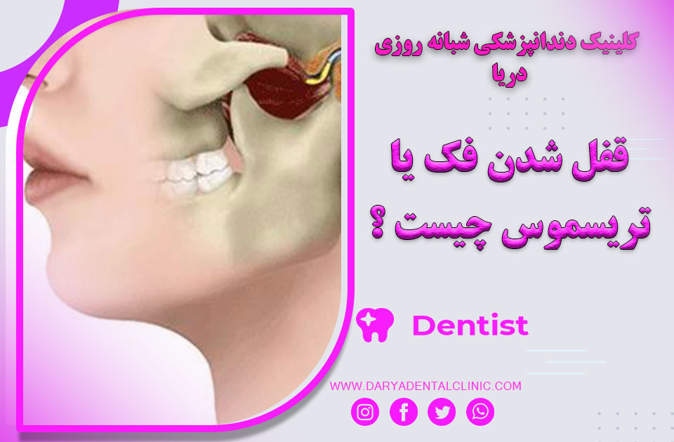 قفل شدن فک یا تریسموس چیست ؟ راه های درمان آن
