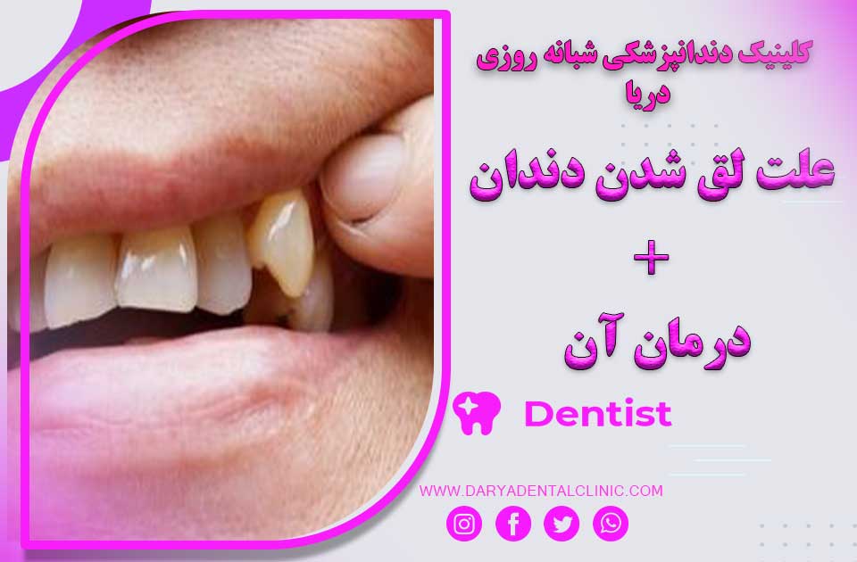 علت لق بودن دندان + درمان آن