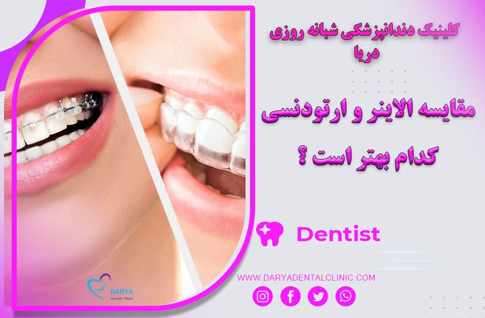 مقایسه الاینر و ارتودنسی: کدام یک بهتر است؟