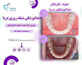 نمونه مرتب سازی دندان و جرم گیری