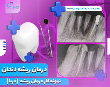 activity image