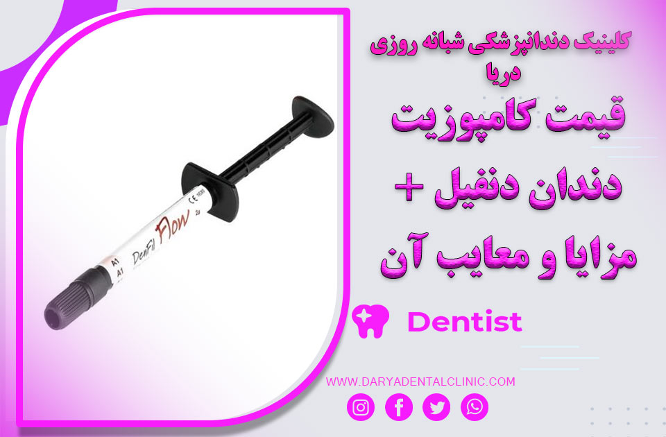 قیمت کامپوزیت دندان دنفیل +مزایا و معایب آن
