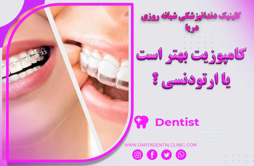 ارتودنسی بهتر است یا کامپوزیت ؟