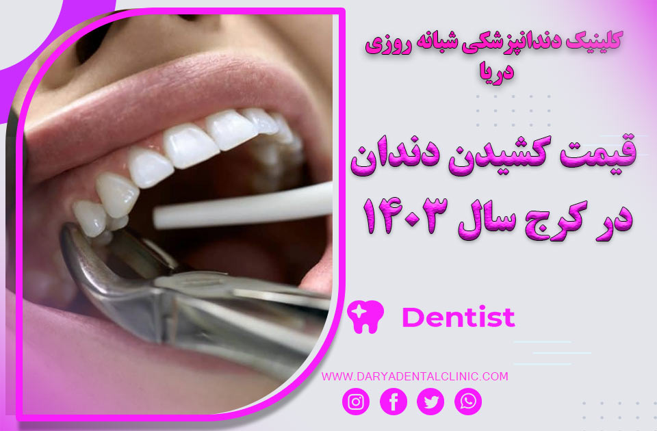 قیمت کشیدن دندان در کرج سال 1404